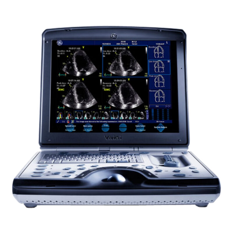 Medical equipment suppliers in Kenya - GE VIVID I Ultrasound (Portable)