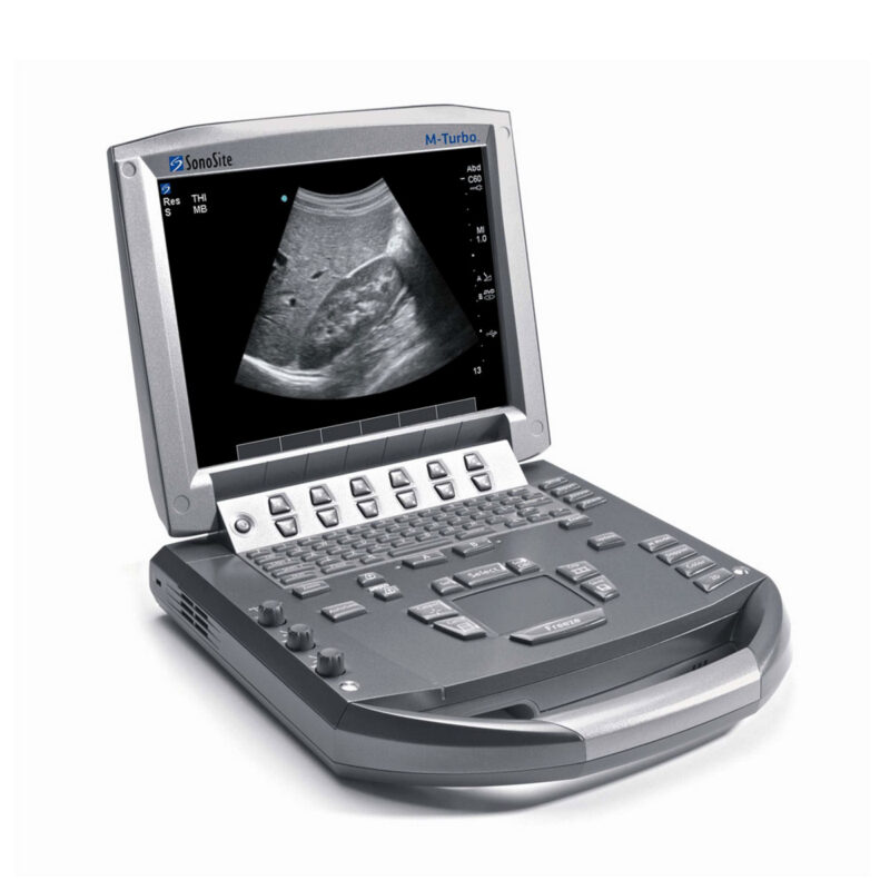Medical equipment suppliers in Kenya - SONOSITE M-TURBO Ultrasound (Portable)