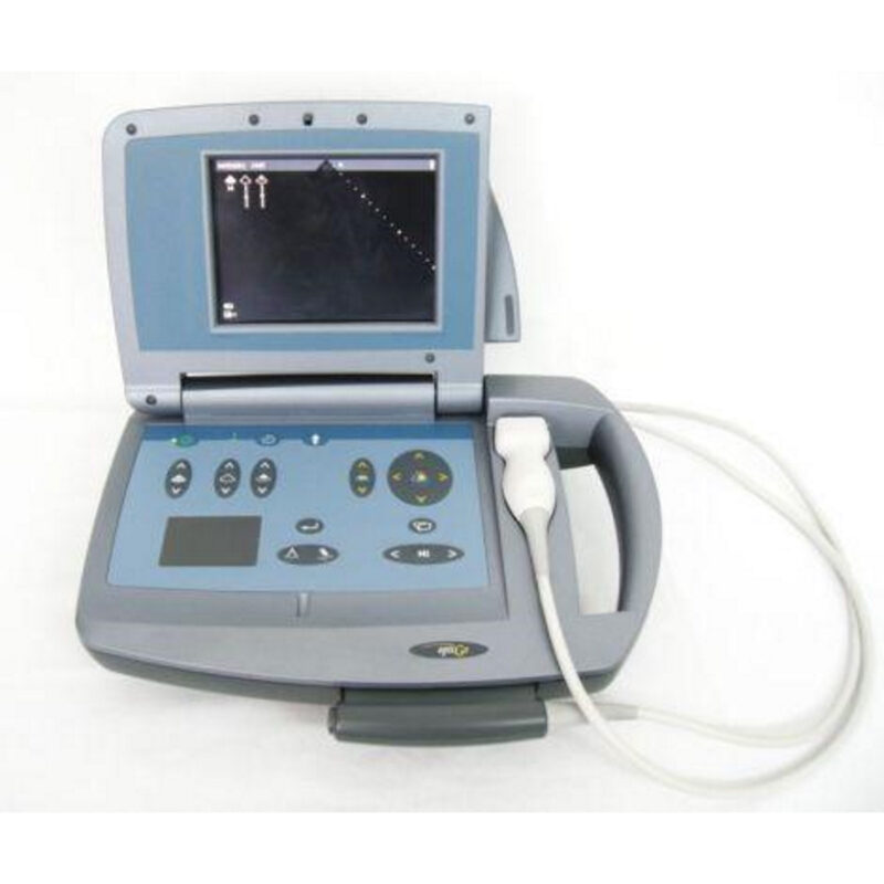 PHILIPS OPTIGO Cardiac Ultrasound (Portable)