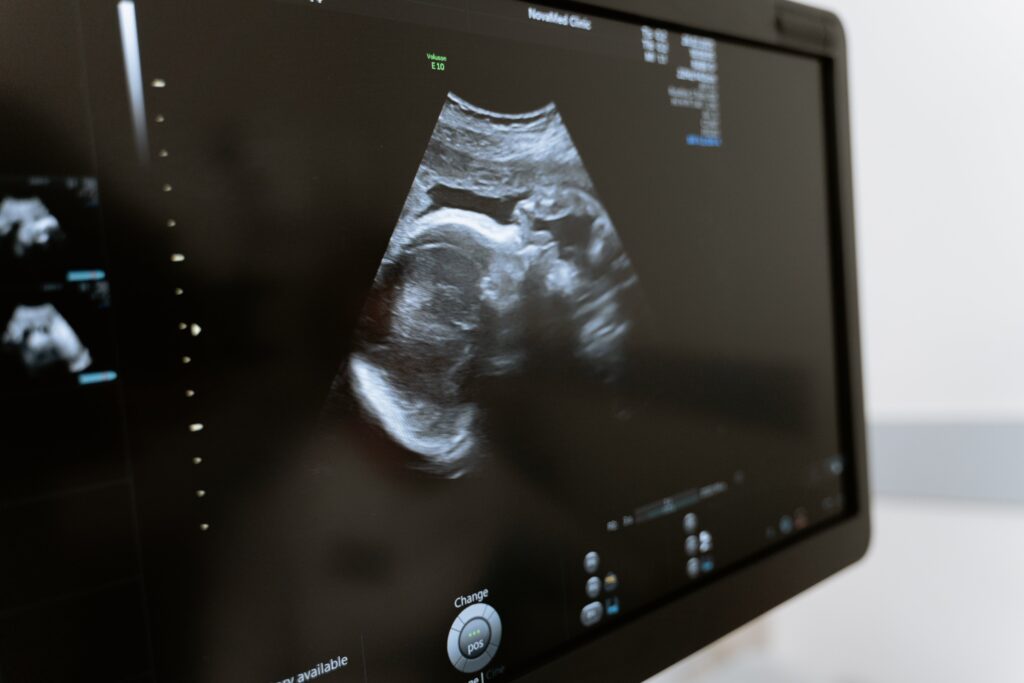 An ultrasound machine is a critical care equipment in any health facility