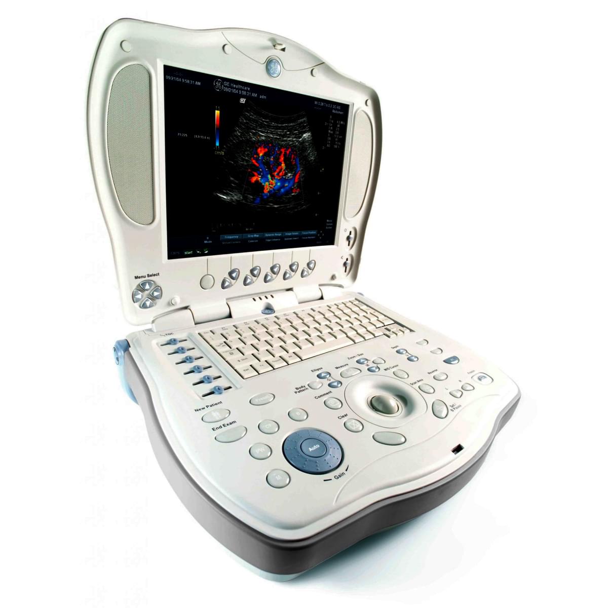 medical equipment suppliers in Kenya -GE LOGIQ XP Ultrasound (Portable)