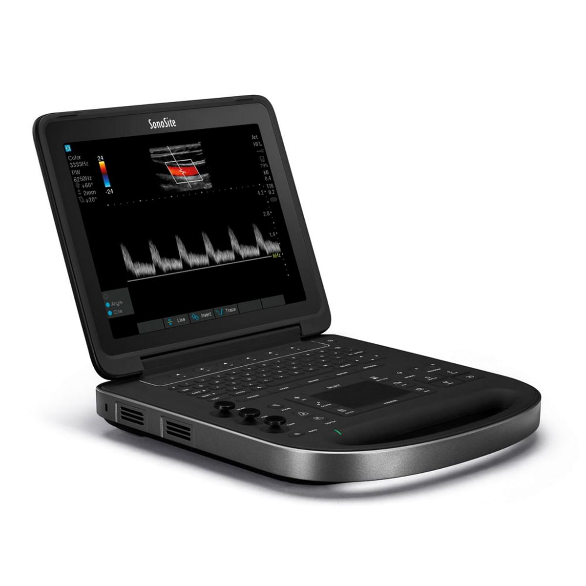 medical equipment suppliers in Kenya -SONOSITE EDGE II Ultrasound (Portable)