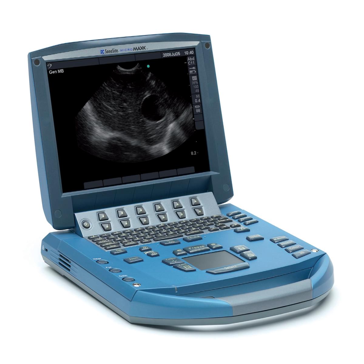 medical equipment suppliers in Kenya -SONOSITE MICROMAXX Ultrasound (Portable)